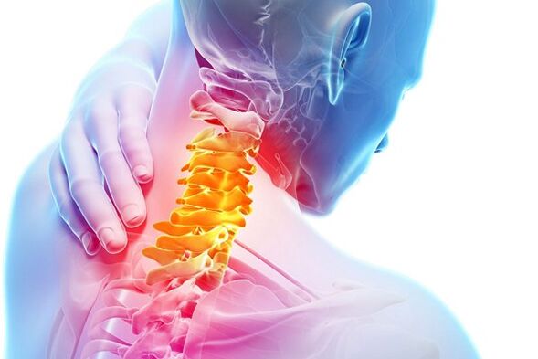 Die Ursachen für zervikale Osteochondose